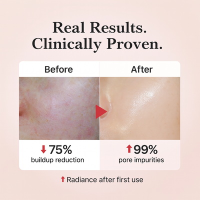 Suvere | Rice Peel Shot